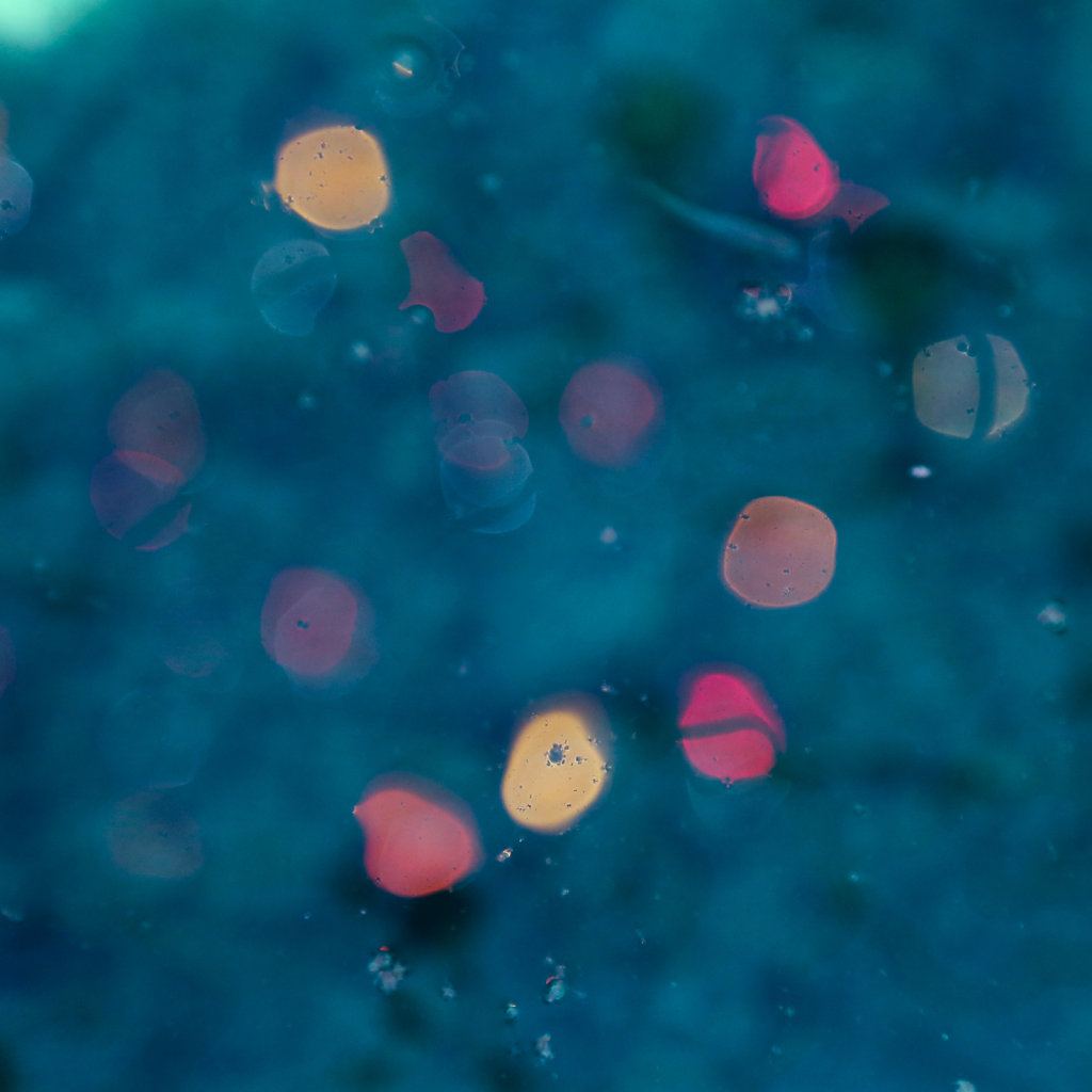 Abstract 02